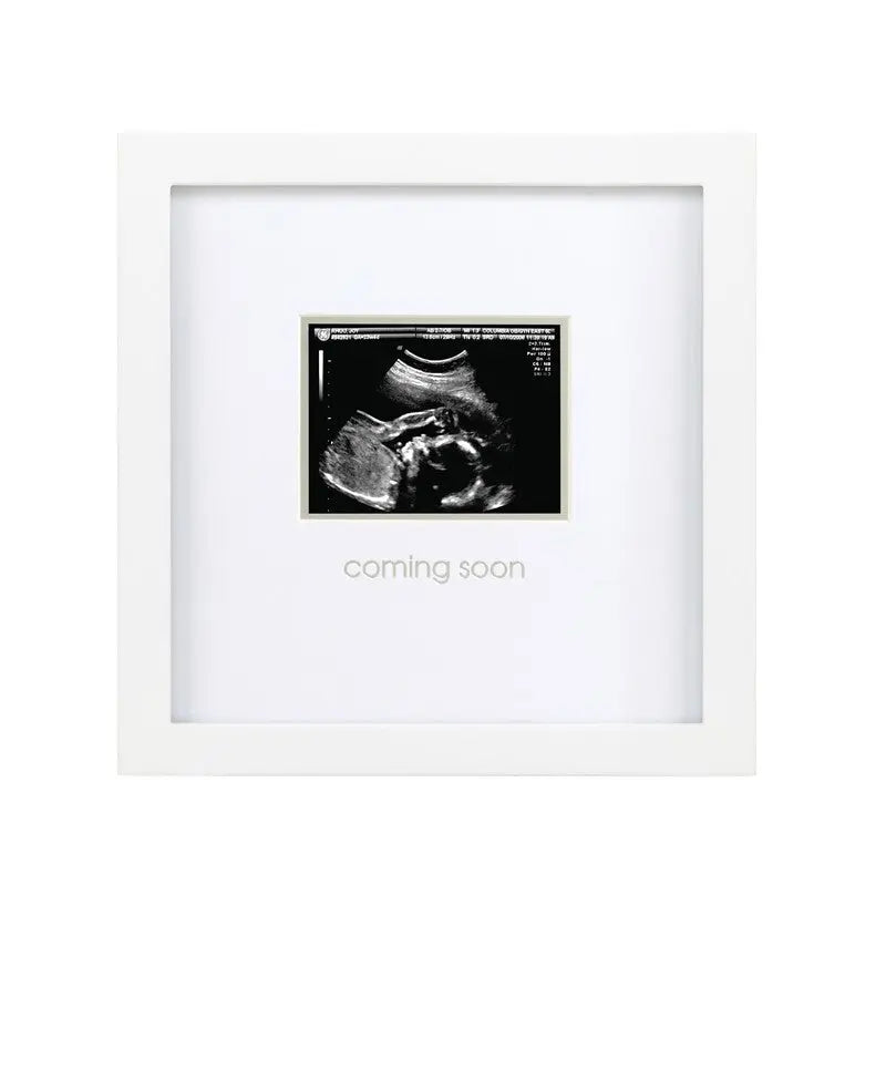 Pearhead Moldura Ecografia Mesa ou Parede Pearhead