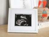 Pearhead Moldura Ecografia Pearhead