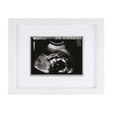 Pearhead Moldura Ecografia Pearhead