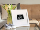 Pearhead Moldura Ecografia Mesa ou Parede Pearhead